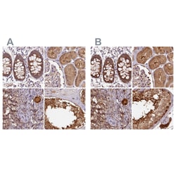 Invitrogen HIP Polyclonal Antibody 100 &mu;L | Buy Online | Invitrogen&trade; | Fisher Scientific