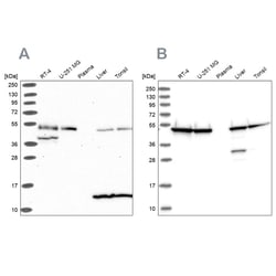 Invitrogen HIP Polyclonal Antibody 100 &mu;L | Buy Online | Invitrogen&trade; | Fisher Scientific