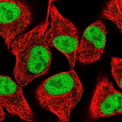 Invitrogen SPANXC Polyclonal Antibody 100 &mu;L; Unconjugated:Antibodies,