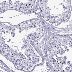 Invitrogen SPANXC Polyclonal Antibody 100 &mu;L; Unconjugated:Antibodies,