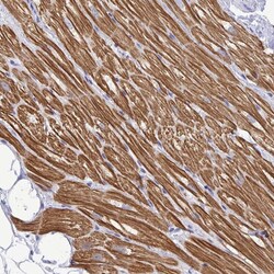 Invitrogen Cardiac Troponin I Polyclonal Antibody 100 &mu;L; Unconjugated:Antibodies,