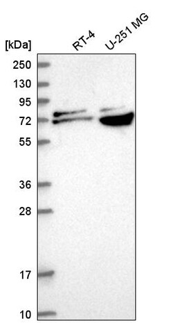 Invitrogen RPA70 Polyclonal Antibody 100 &mu;L | Buy Online | Invitrogen&trade; | Fisher Scientific