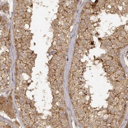 Invitrogen CDK5RAP2 Polyclonal Antibody 100 &mu;L; Unconjugated:Antibodies,
