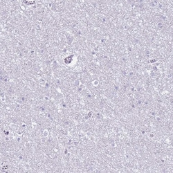 Invitrogen CD177 Polyclonal Antibody 100 &mu;L | Buy Online | Invitrogen&trade; | Fisher Scientific