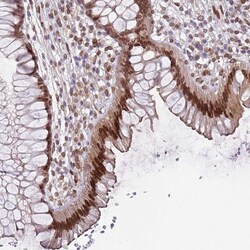 Invitrogen C1orf145 Polyclonal Antibody 100 &mu;L; Unconjugated:Antibodies,