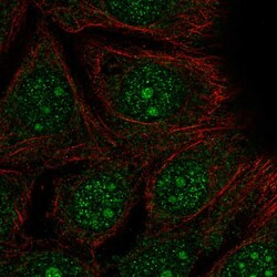 Invitrogen DEGS2 Polyclonal Antibody 100 &mu;L | Buy Online | Invitrogen&trade; | Fisher Scientific