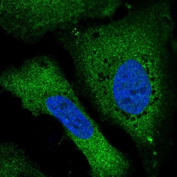 Invitrogen RALBP1 Polyclonal Antibody 100 &mu;L; Unconjugated:Antibodies,