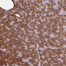 Invitrogen RALBP1 Polyclonal Antibody 100 &mu;L; Unconjugated:Antibodies,
