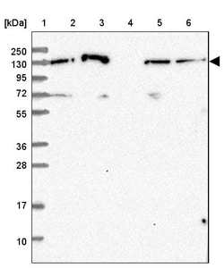 Invitrogen NOMO1 Polyclonal Antibody 100 &mu;L; Unconjugated:Antibodies,