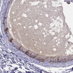 Invitrogen SPINT4 Polyclonal Antibody 100 &mu;L; Unconjugated:Antibodies,