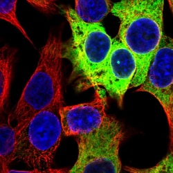 Invitrogen CES1 Polyclonal Antibody 100 &mu;L; Unconjugated:Antibodies,