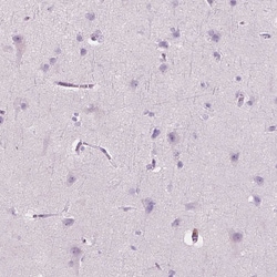 Invitrogen CES1 Polyclonal Antibody 100 &mu;L; Unconjugated:Antibodies,