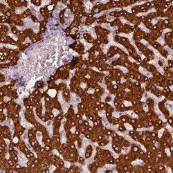 Invitrogen CES1 Polyclonal Antibody 100 &mu;L; Unconjugated:Antibodies,