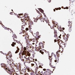 Invitrogen CES1 Polyclonal Antibody 100 &mu;L; Unconjugated:Antibodies,