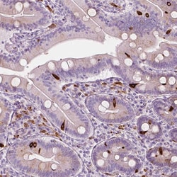 Invitrogen CES1 Polyclonal Antibody 100 &mu;L; Unconjugated:Antibodies,