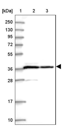 Invitrogen PP1 alpha Polyclonal Antibody 100 &mu;L; Unconjugated:Antibodies,