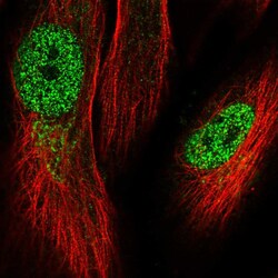 Invitrogen KRBOX1 Polyclonal Antibody 100 &mu;L; Unconjugated:Antibodies,