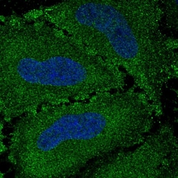 Invitrogen G7C Polyclonal Antibody 100 &mu;L | Buy Online | Invitrogen&trade; | Fisher Scientific