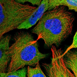 Invitrogen HIP Polyclonal Antibody 100 &mu;L; Unconjugated:Antibodies,