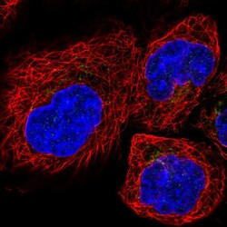TMP21 Polyclonal Antibody:Antibodies, Polyclonal