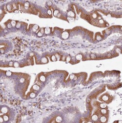 TMP21 Polyclonal Antibody:Antibodies, Polyclonal