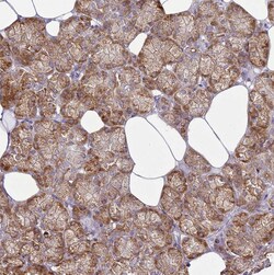 TMP21 Polyclonal Antibody:Antibodies, Polyclonal
