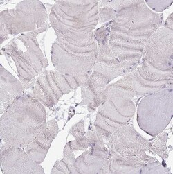 TMP21 Polyclonal Antibody:Antibodies, Polyclonal