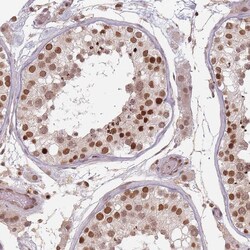 Invitrogen NUP50 Polyclonal Antibody 100 &mu;L; Unconjugated:Antibodies,