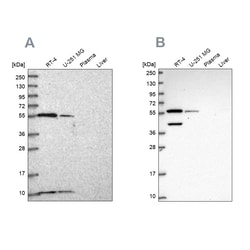 Invitrogen NUP50 Polyclonal Antibody 100 &mu;L; Unconjugated:Antibodies,