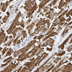 Invitrogen SIRPB1 Polyclonal Antibody 100 &mu;L; Unconjugated:Antibodies,