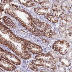 Invitrogen PRR23A Polyclonal Antibody 100 &mu;L; Unconjugated:Antibodies,