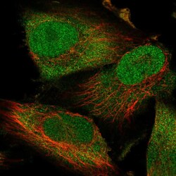Invitrogen Thioredoxin 1 Polyclonal Antibody 100 &mu;L; Unconjugated:Antibodies,