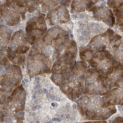Invitrogen RPL32 Polyclonal Antibody 100 &mu;L; Unconjugated:Antibodies,