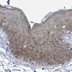 Invitrogen RPL32 Polyclonal Antibody 100 &mu;L; Unconjugated:Antibodies,