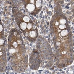 Invitrogen RPL32 Polyclonal Antibody 100 &mu;L; Unconjugated:Antibodies,