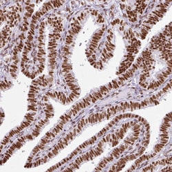 Invitrogen Ku70 Polyclonal Antibody 100 &mu;L; Unconjugated:Antibodies,