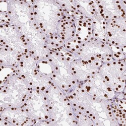 Invitrogen Ku70 Polyclonal Antibody 100 &mu;L; Unconjugated:Antibodies,