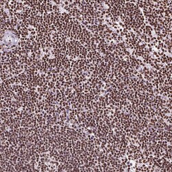 Invitrogen Ku70 Polyclonal Antibody 100 &mu;L; Unconjugated:Antibodies,