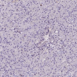 SH2D3C Polyclonal Antibody:Antibodies, Polyclonal
