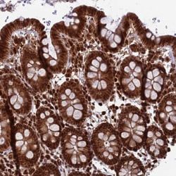 Invitrogen FUBP3 Polyclonal Antibody 100 &mu;L; Unconjugated:Antibodies,