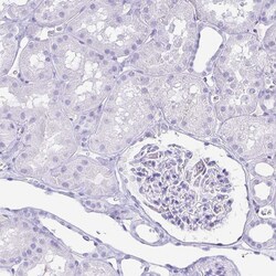 Invitrogen GKN1 Polyclonal Antibody 100 &mu;L; Unconjugated:Antibodies,