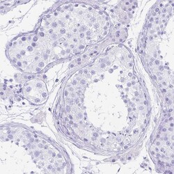 Invitrogen GKN1 Polyclonal Antibody 100 &mu;L; Unconjugated:Antibodies,