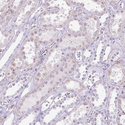 Invitrogen HSD11B1 Polyclonal Antibody 100 &mu;L; Unconjugated:Antibodies,