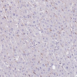 PPAP2A Polyclonal Antibody:Antibodies, Polyclonal