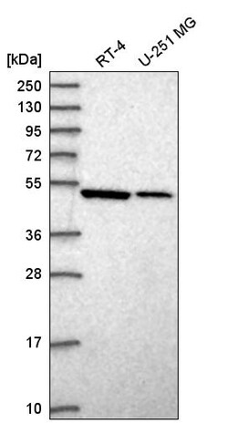 Invitrogen Septin-10 Polyclonal Antibody 100 &mu;L; Unconjugated:Antibodies,