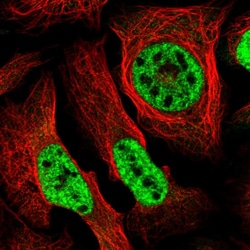SEPHS2 Polyclonal Antibody:Antibodies, Polyclonal