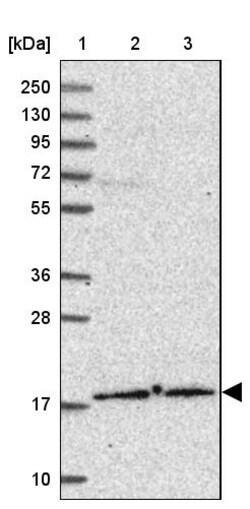 Invitrogen POLE3 Polyclonal Antibody 100 &mu;L | Buy Online | Invitrogen&trade; | Fisher Scientific