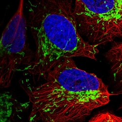 Invitrogen TOM70 Polyclonal Antibody 100 &mu;L; Unconjugated:Antibodies,