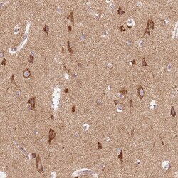 Invitrogen TOM70 Polyclonal Antibody 100 &mu;L; Unconjugated:Antibodies,
