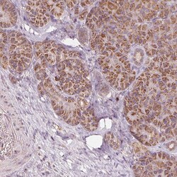 Invitrogen TOM70 Polyclonal Antibody 100 &mu;L; Unconjugated:Antibodies,
